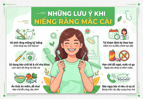 Những lưu ý khi niềng răng mắc cài